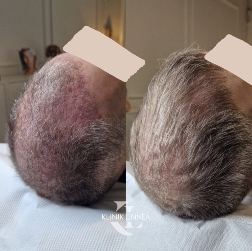 Cellbooster HAIR