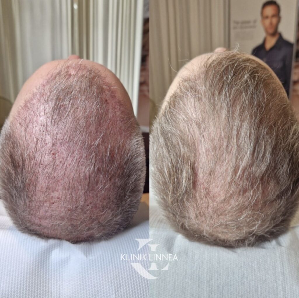 Cellbooster HAIR