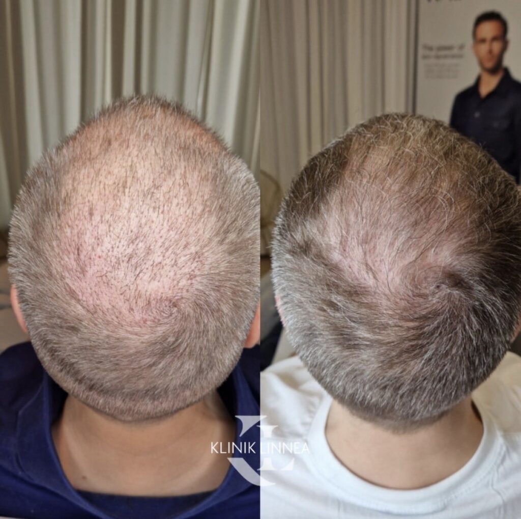 Cellbooster HAIR
